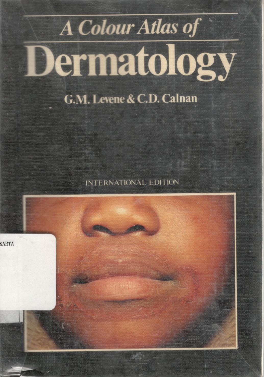 A Colour atlas of dermatology / G. M. Levene, C. D. Calnan 